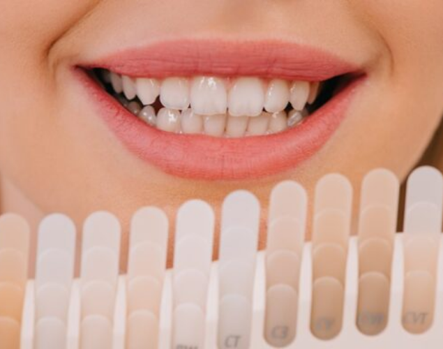 A close up photo of a lady's teeth after she has had veneers.